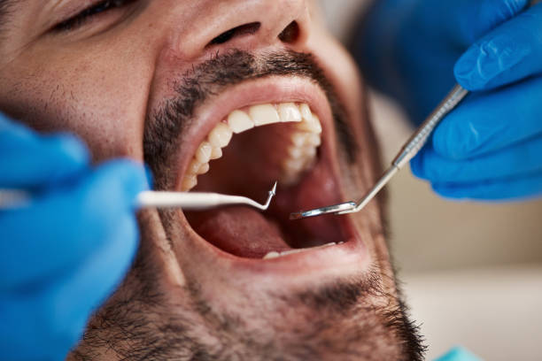 Best After-Hours Dental Care in Fayetteville, NC